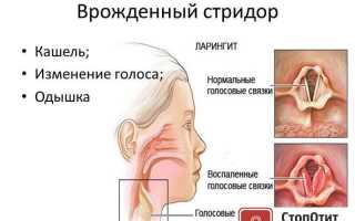 Врожденный стридор: диагностика и лечение