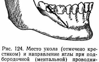 Как проводят ментальную анестезию в стоматологии?