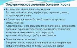 Когда необходима операция при болезни Крона? Подготовка и реабилитация