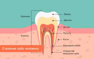 Какие есть методы пломбирования зубных каналов?