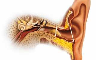 Шум в ушах и заложенность без боли