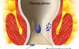 Сколько длится больничный при геморрое, в каких случаях выписывают бюллетень?