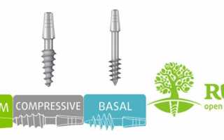 Зубные импланты Roott – швейцарское качество по доступной цене