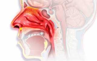 Как протекает острый ринит у детей и взрослых?