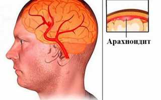 Арахноидит: симптомы и лечение