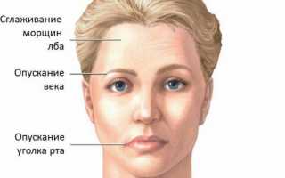 Какими способами лечат воспаление тройничного нерва?