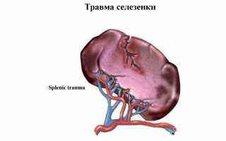 Ушиб селезенки что делать