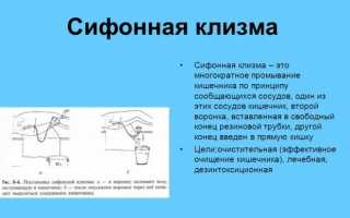 Как выполняется сифонная клизма?