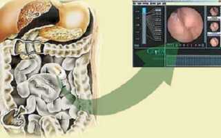 Что такое капсульная эндоскопия, где проводится и сколько стоит процедура?