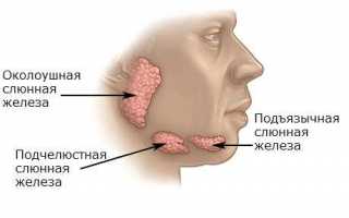 Что делать при возникновении закупорки слюнной железы?