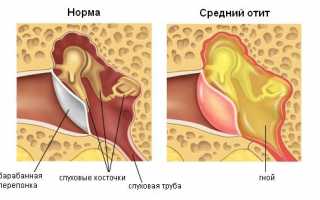 Почему щелкает в ухе: основные причины и лечение