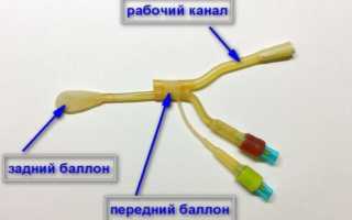 Как проводится ЯМИК-процедура при гайморите?