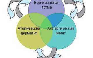 Симптомы и лечение атопической аллергии