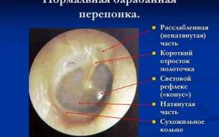 Роль барабанной перепонки, повреждения, симптомы и лечение