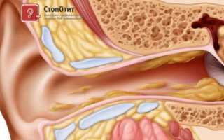 Как почистить уши ребенку от серы?