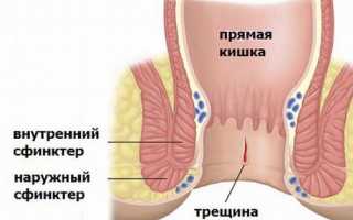 Чем занимается врач-проктолог и как попасть бесплатно на приём?