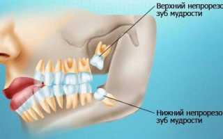 Почему ноет зуб и что делать в такой ситуации?