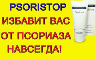 Применение нано-геля “PsoriStop”