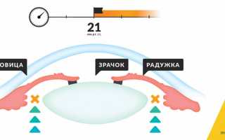 Закрытоугольная глаукома — что будет если не лечить?