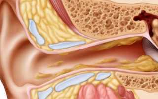 Боль в ухе после чистки ватной палочкой: основные причины